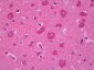 PRKCE / PKC-Epsilon Antibody